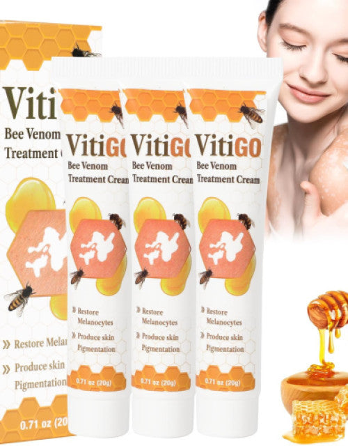 Vitiligo Bee Venom Treatment Cream (Pack of 2)